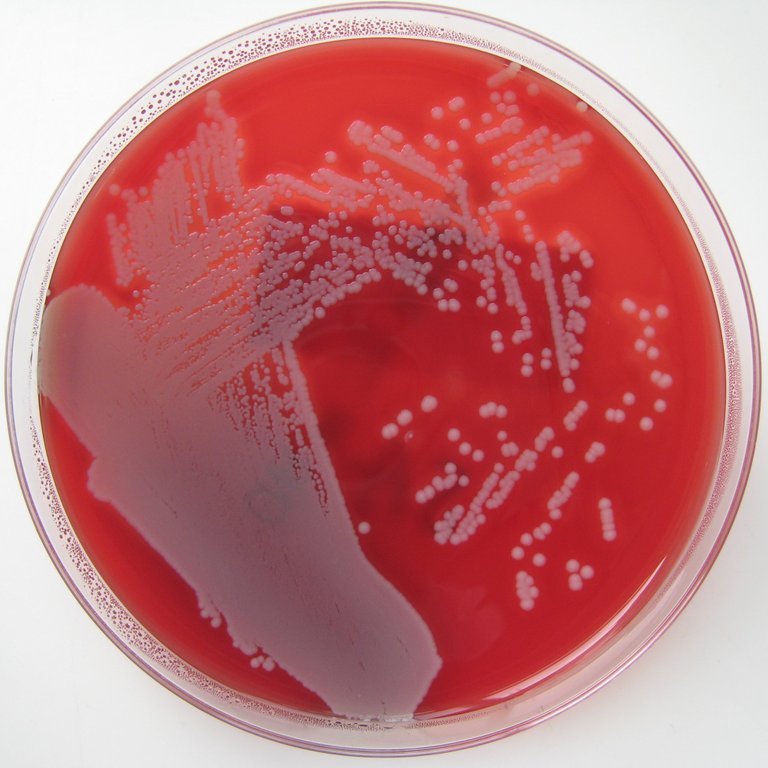 Staphylococcus_aureus_agar_sangre.jpg