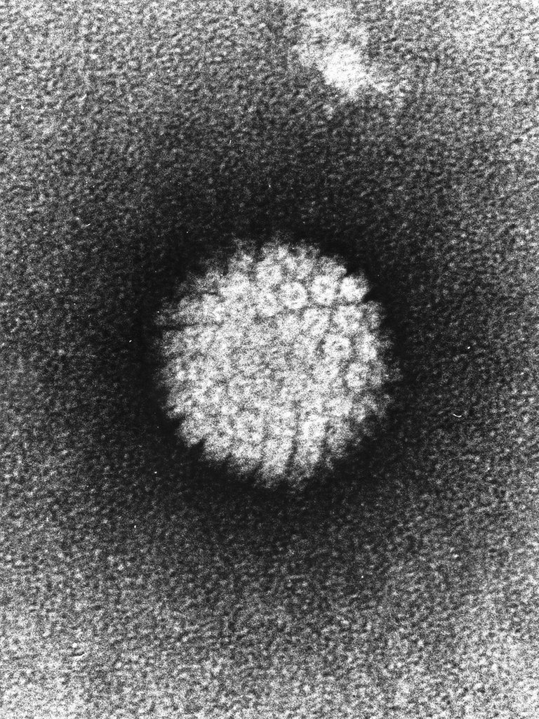 Papilloma_Virus_HPV_EM.jpg