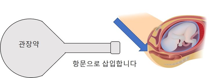 -3대 굴욕-관장과 내진3