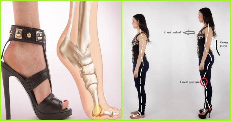 10-Side-Effects-Of-Wearing-High-Heels-1-1.jpg