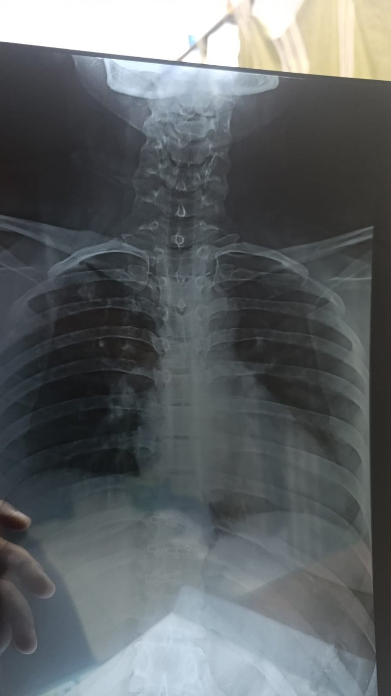 Always a good decision to go x ray when problem is chronic