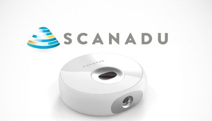 scanadu-scout-7x4.jpg