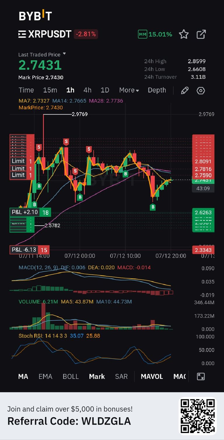 Trading decisions on xrp 