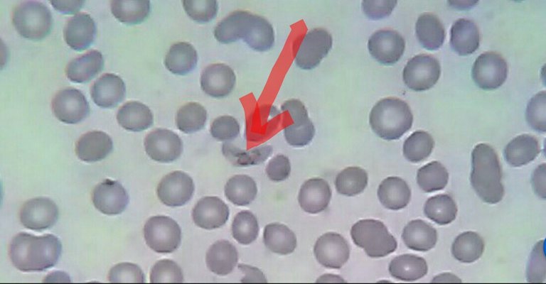 Plasmodium falciparum. Parásito causante de la Malaria