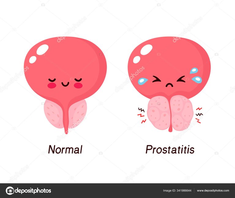 depositphotos_341986644_stock_illustration_normal_prostate_and_benign_prostatic.jpg
