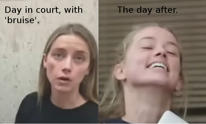 ah_bruiseafterdayincourt3.png