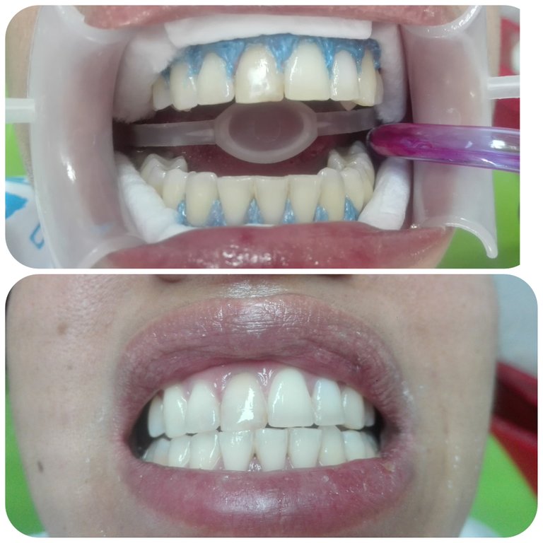 CollageMaker_20210416_105909842.jpg