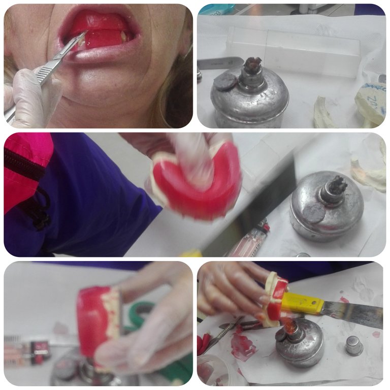 CollageMaker_20210410_193523193.jpg