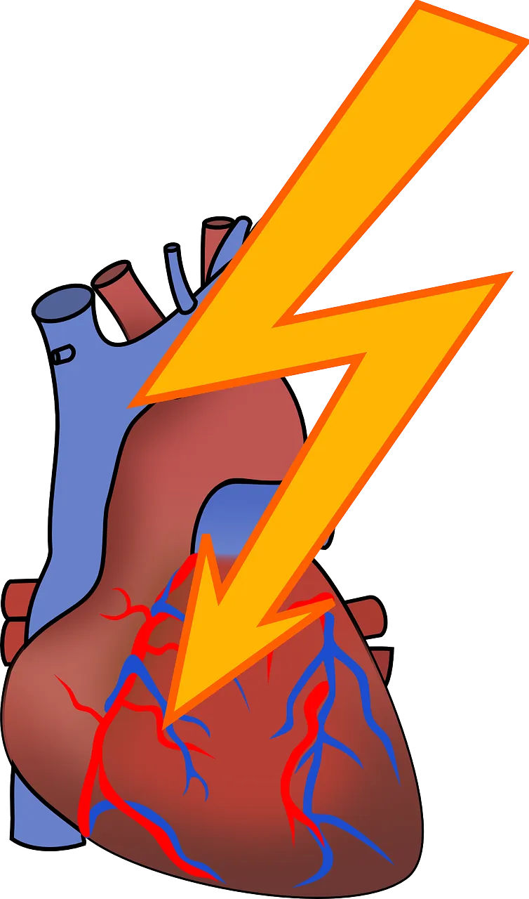 arrhythmia-156099_1280.webp