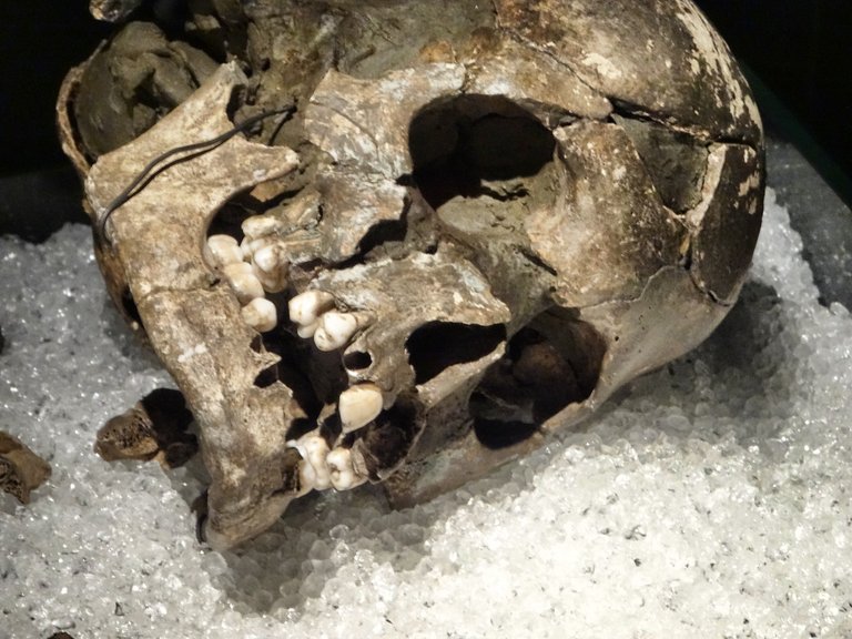 A vikings skull from Stavanger