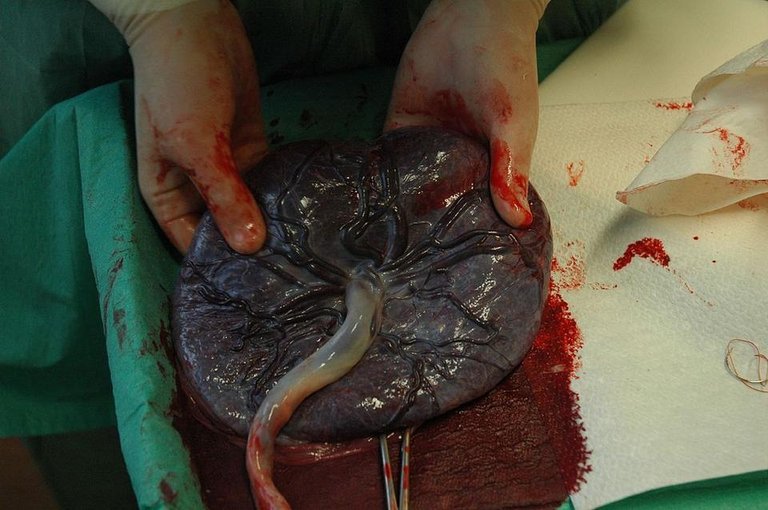 1024px-Placenta_held.jpg