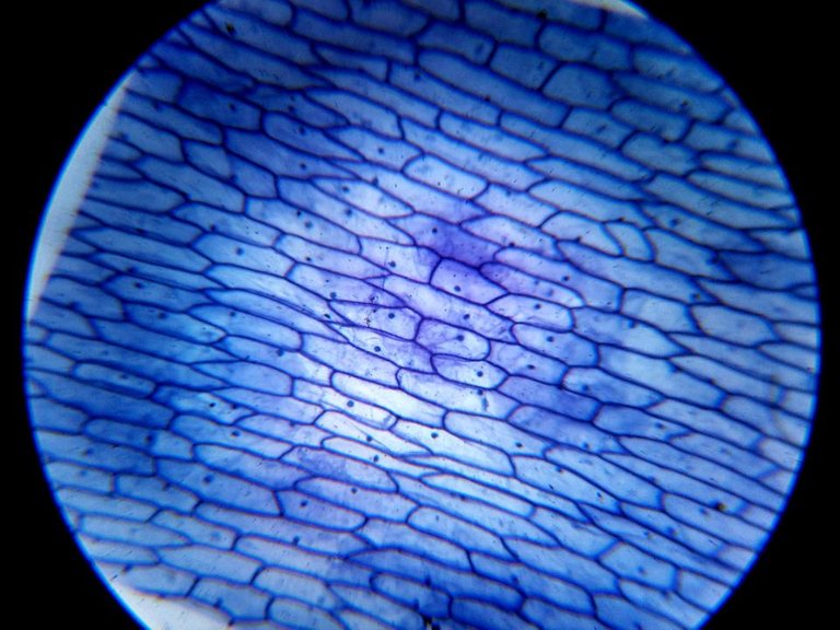 Epidermis onion 01.jpg