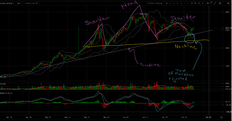 BTCUSD HS Rejection.png