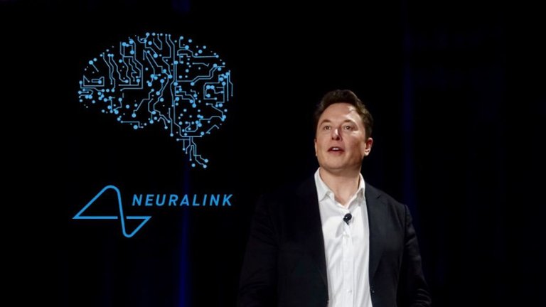 Neuralink