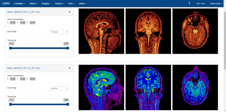 loris-mri-scans.png