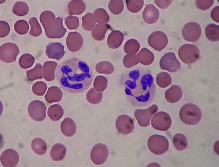 Segmented_neutrophils.jpg