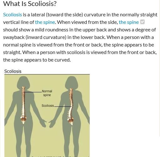 scoliosis  What is Scoliosis