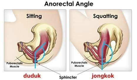 https://s3.us-east-2.amazonaws.com/partiko.io/img/winruhdikopi-fakta-medis-sehatnya-kencing-jongkok-1532052749821.png