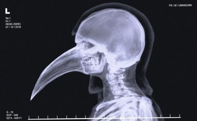 SCP-049  The plague doctor 