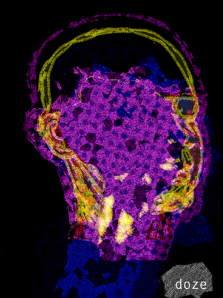 ntopaz-image-0