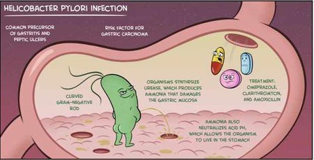 helicobacter.jpg