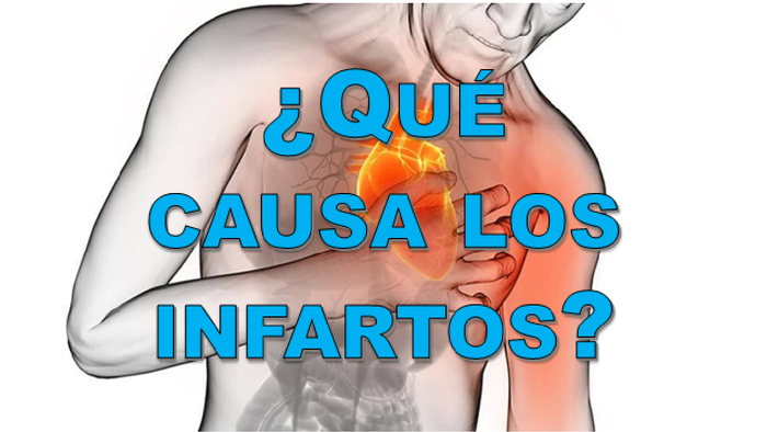 miniatura infartos.png