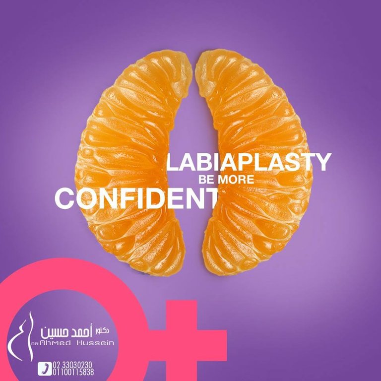 labiaplasty.jpg