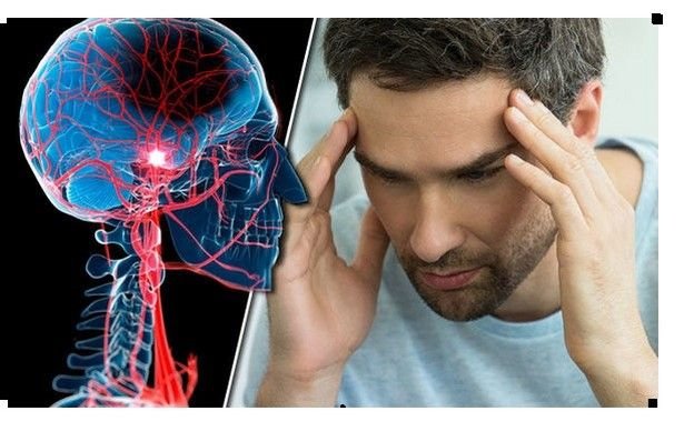 Stroke-headache-migraine-cardiovascular-disease-uk-912960.jpg