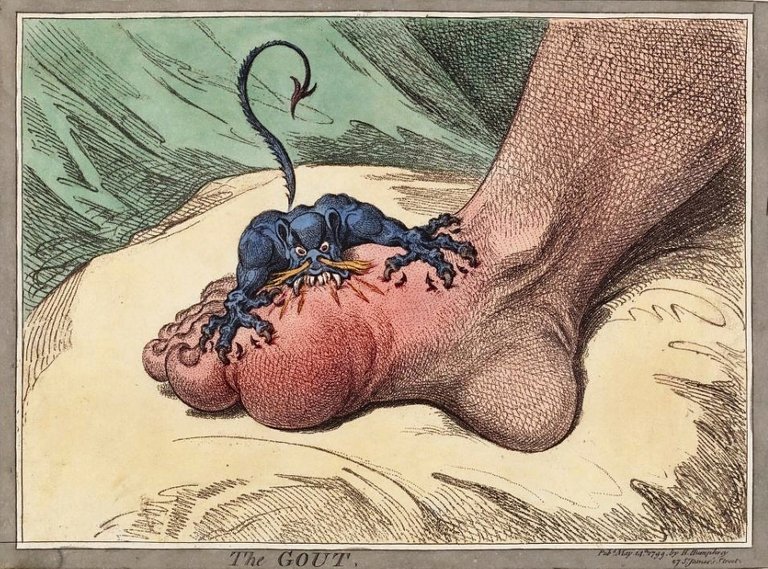 classic Gout pic.jpg