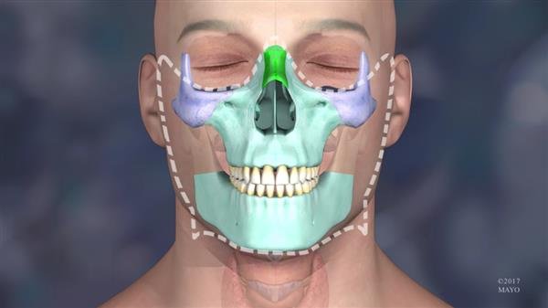 32-year-old-undergoes-successful-face-transplant-thanks-3d-printing-mayo-clinic-5.jpg