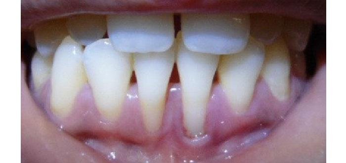 teeth-health.jpg