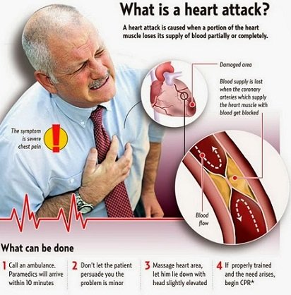 Top-12-Heart-Attack-Warning-Signs1.jpg