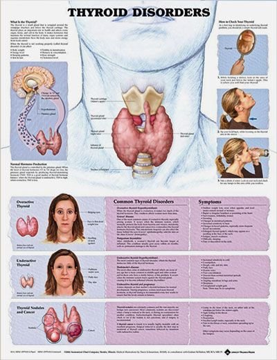 thyroid disorders.jpg