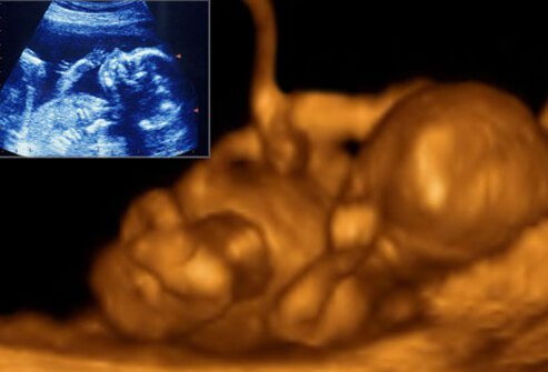 fetal_ultrasound_20_weeks_s8.jpg