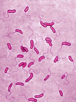 vibrio-cholerae.jpg