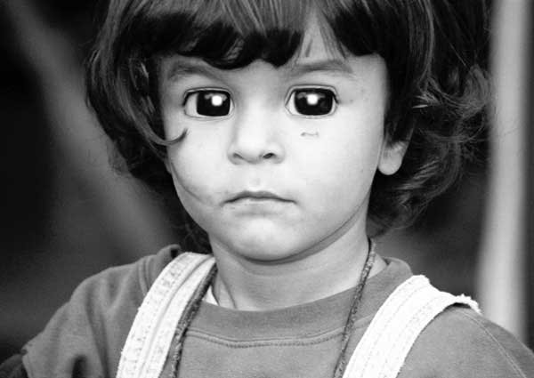 35-16-child-square-eyes1.jpg