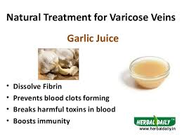 homeopathic remedies varicosis 2.png