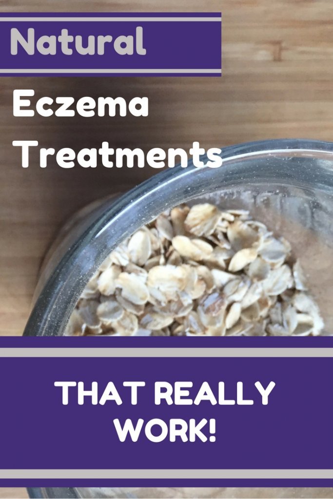 Natural-Eczema-treatments-683x1024.jpg