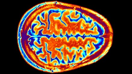 agendapucp-fisica_medica-440x247.jpg