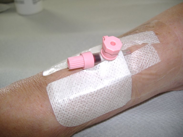 Placement_of_intravenous_cannula_3.jpg