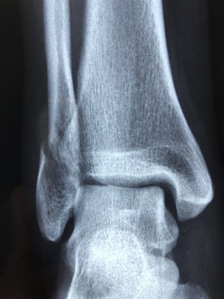 radiography-3057768_1920.jpg