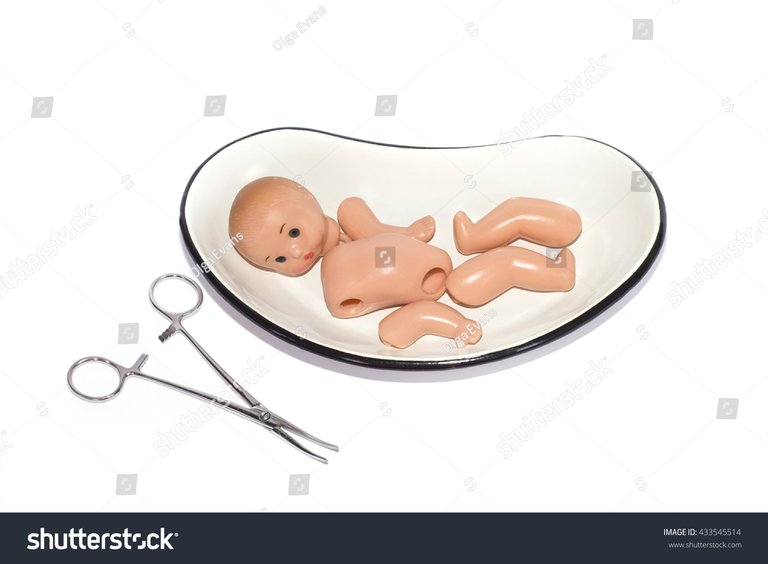 stock-photo-the-symbol-of-abortion-baby-433545514.jpg