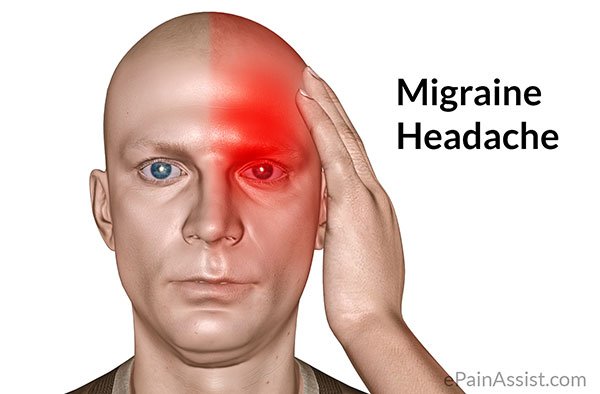 Migraine-Headache-1.jpg