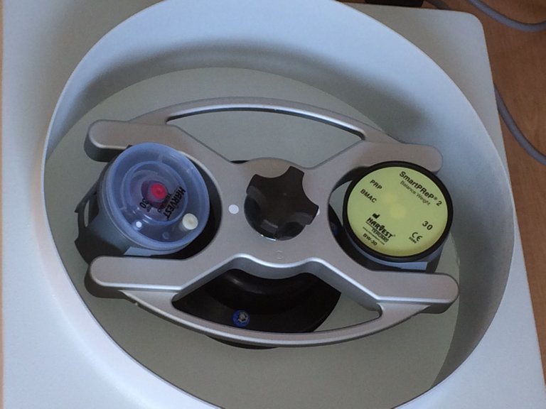 PRP_Centrifuge.JPG