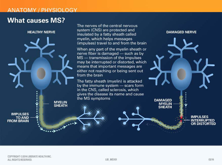 Multiple-Sclerosis-FD4-Anatomy.png