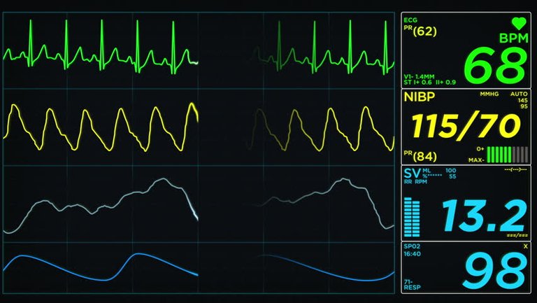 heartbeat.jpg