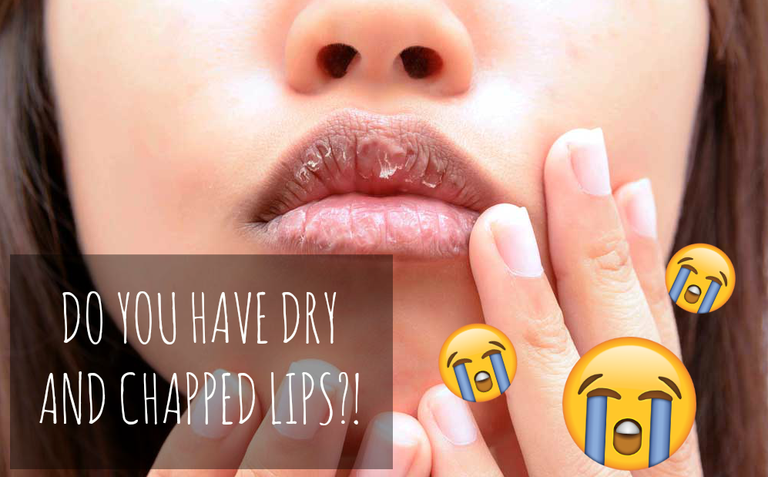 CHAPPEDLIPS.PNG