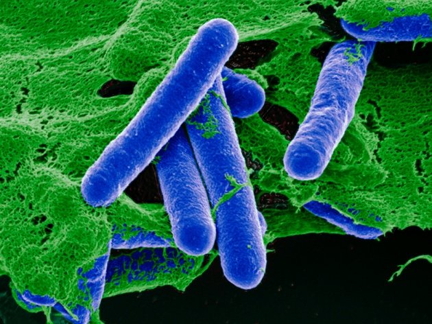 clostridium-botulinum.jpg