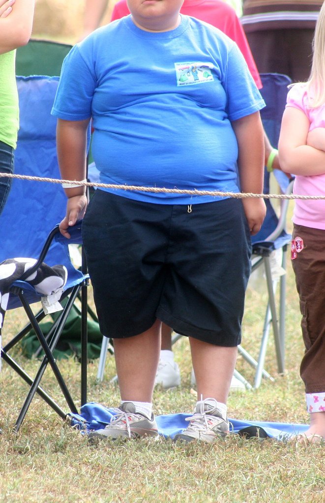 obesity in adults.jpg