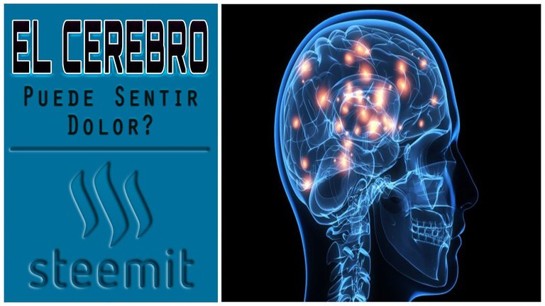 El Cerebro Puede Sentir Dolor.jpg